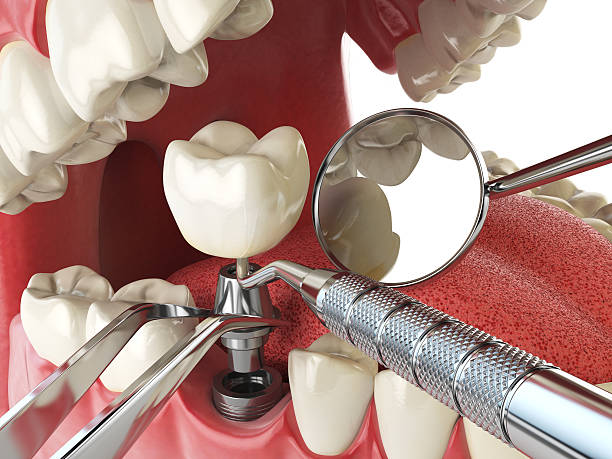 Best Emergency Dental Clinic in CA